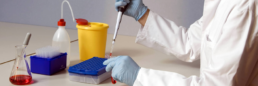 rcb lab